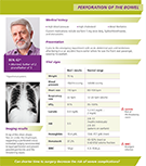Patient Case Study – Perforation of the Bowel